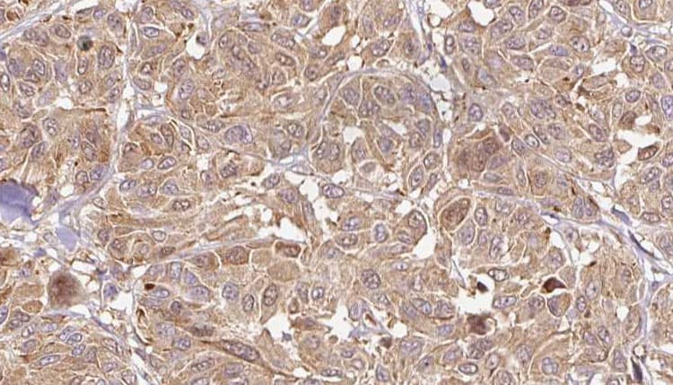 Polyclonal Rabbit anti-Human MYDGF / SF20 Antibody (IHC, WB)