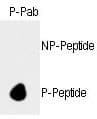 RB1 / Retinoblastoma / RB Antibody (phospho-Ser788)