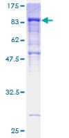 Human CILD9 / DNAI2 Protein (Recombinant GST)