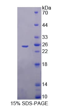 Human TREH Protein (Recombinant His-T7)