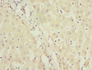 Polyclonal Rabbit anti-Human JADE1 / PHF17 Antibody (IHC)