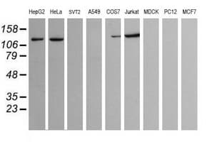 Monoclonal Mouse anti-Human PIK3CG / PI3K Gamma Antibody (clone OTI6C6, IHC, WB)