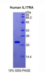 Human IL17RA Protein (Recombinant His)