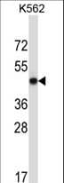 METAP2 Antibody (aa33-61)