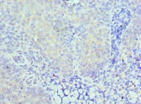 Polyclonal Rabbit anti-Human CARD8 / Cardinal / TUCAN Antibody (aa1-200, IHC)