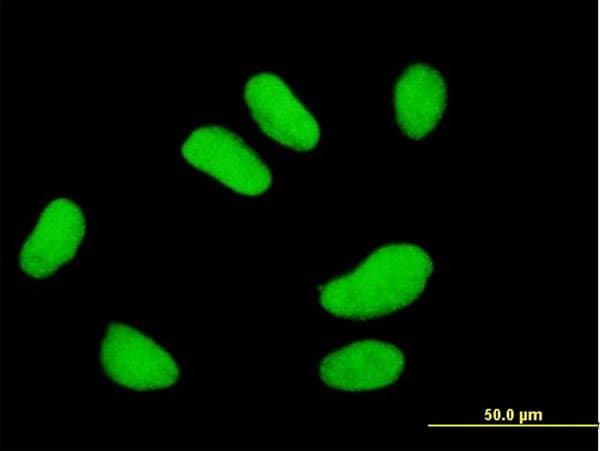 Monoclonal Mouse anti-Human UBE2E2 / UBCH8 Antibody (clone 4B4, IF, WB)