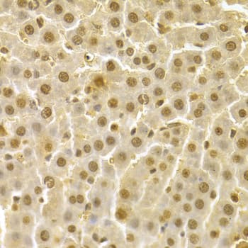 Polyclonal Rabbit anti-Human CDK4 Antibody (IHC, IF, WB)