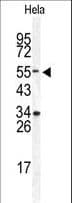 DONSON / B17 Antibody (aa368-398)