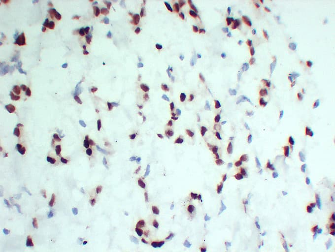 PR / Progesterone Receptor Antibody (clone ABT-PR)