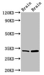 Polyclonal Rabbit anti-Human HAX-1 Antibody (IHC, WB)
