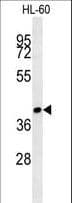 ST8SIA3 Antibody (aa312-340)