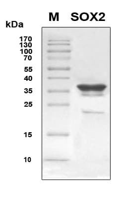Human SOX2 Protein (Recombinant 6His, N-terminus)