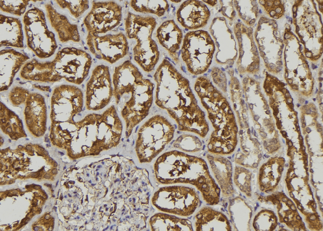 MAC-2-BP / LGALS3BP Antibody