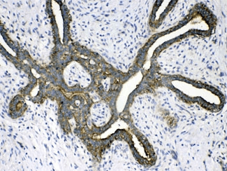 PSAT1 Antibody