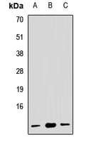 RPL19 / Ribosomal Protein L19 Antibody