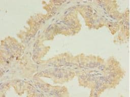UBE2D1 / UBCH5 Antibody