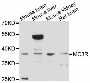 Polyclonal Rabbit anti-Human MC3R / MC3 Receptor Antibody (WB)