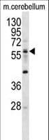 Polyclonal Rabbit anti-Human ELP3 Antibody (aa9-44, WB)