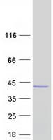 Human ASPA Protein (Recombinant Myc-DDK (Flag))