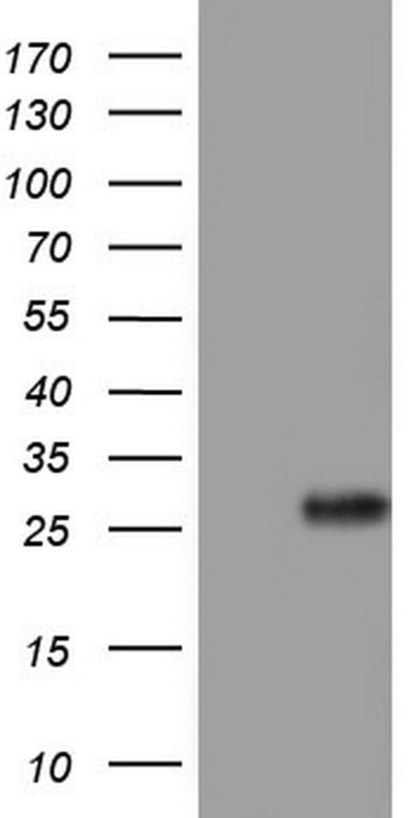 Monoclonal Mouse anti-Human Adiponectin Antibody (clone OTI3F12, aa19-244, IHC, WB)
