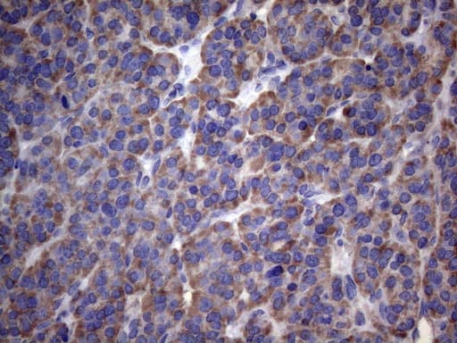 PAPSS2 Antibody (aa1-247, clone OTI6H10)