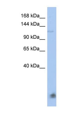CEB1 / HERC5 Antibody (aa287-336)