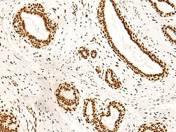 NF90 / ILF3 Antibody