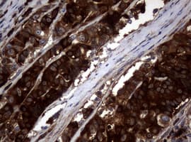 NME1 / NM23 Antibody (clone OTI24A2)