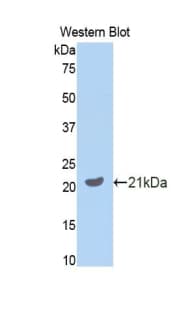 PathPlus™ GAS6 Antibody (aa483-646)