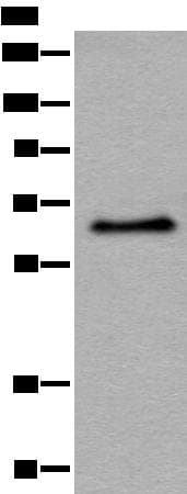 ATF7 Antibody
