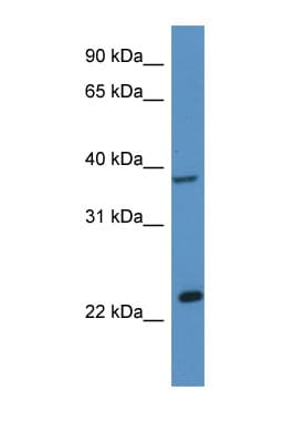 ERCC1 Antibody (aa191-240)