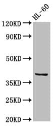 CCRL2 Antibody