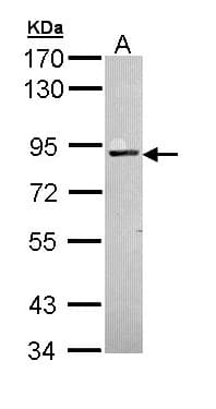 IHC-plus™ PRKCA / PKC-Alpha Antibody (aa1-250)