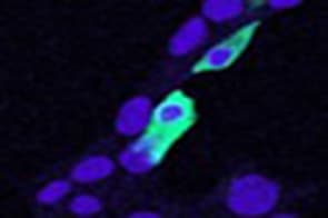IHC-plus™ CLIC4 Antibody (aa8-20)