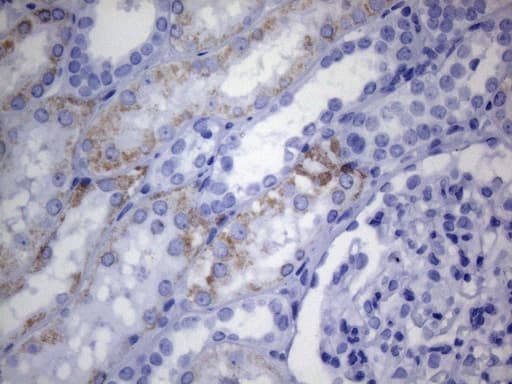 AMACR / P504S Antibody (clone UMAB215, Carrier-free)