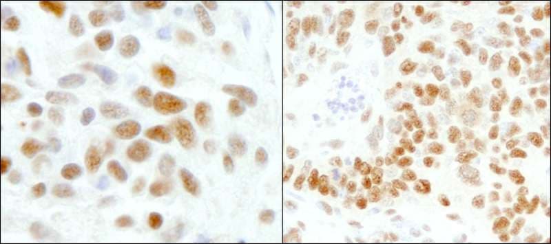 GTF2I / TFII I Antibody (aa985-998)