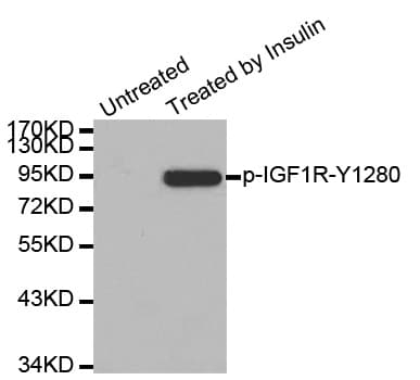 IGF1R / IGF1 Receptor Antibody (phospho-Tyr1280)