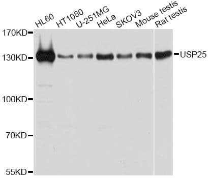 Polyclonal Rabbit anti-Human USP25 Antibody (IHC, WB)