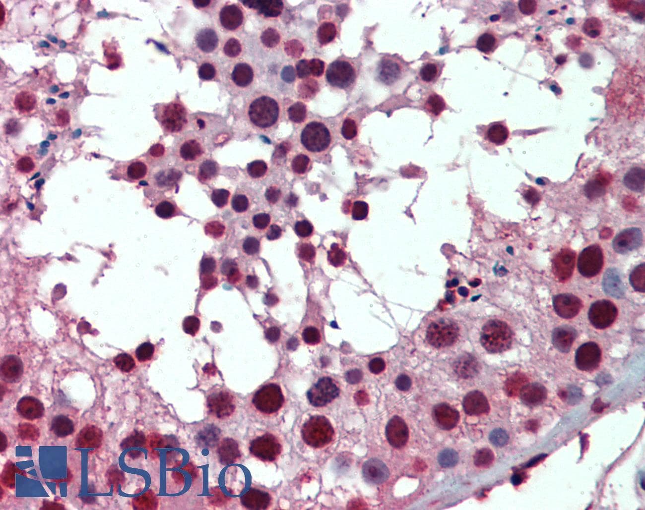 IHC-plus™ RBM8A / Y14 Antibody (clone 3E4)