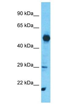 SYCP3 / SCP3 Antibody (aa7-56)