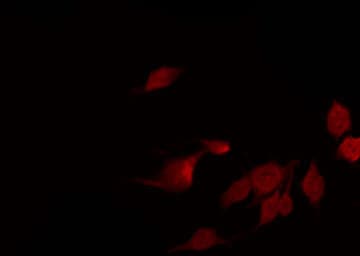 NFKBIA / IKB Alpha / IKBA Antibody