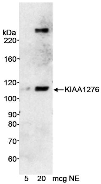Polyclonal Rabbit anti-Human KIAA1276 / FAM184B Antibody (aa1000-C-term, WB)