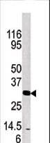 Polyclonal Rabbit anti-Human KLK3 / PSA Antibody (aa220-250, WB)