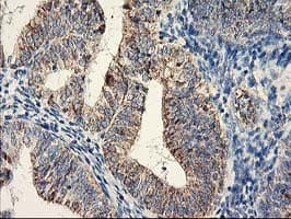 DAND5 Antibody (clone OTI2H3)