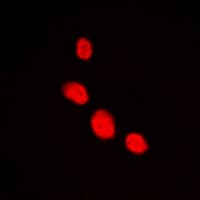 Polyclonal Rabbit anti-Human LHX1 Antibody (Internal, IF, WB)