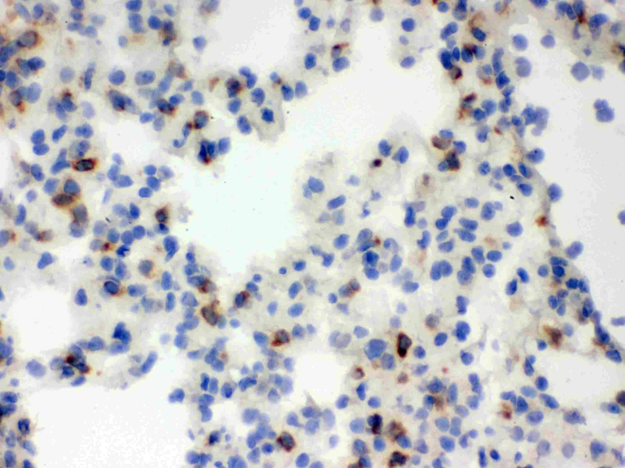 Polyclonal Rabbit anti-Rat LCN2 / Lipocalin 2 / NGAL Antibody (aa21-198, IHC, WB)