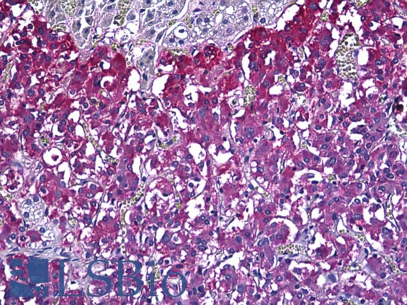 IHC-plus™ Polyclonal Rabbit anti-Human CIB2 / KIP2 Antibody (aa21-70, IHC)