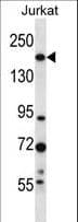 UGGT1 / UGGT Antibody (aa1226-1254)