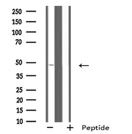 Polyclonal Rabbit anti-Human SCTR / SR / Secretin Receptor Antibody (IF, WB)