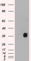 Monoclonal Mouse anti-Human CD2 Antibody (clone OTI9D1, IHC, WB)